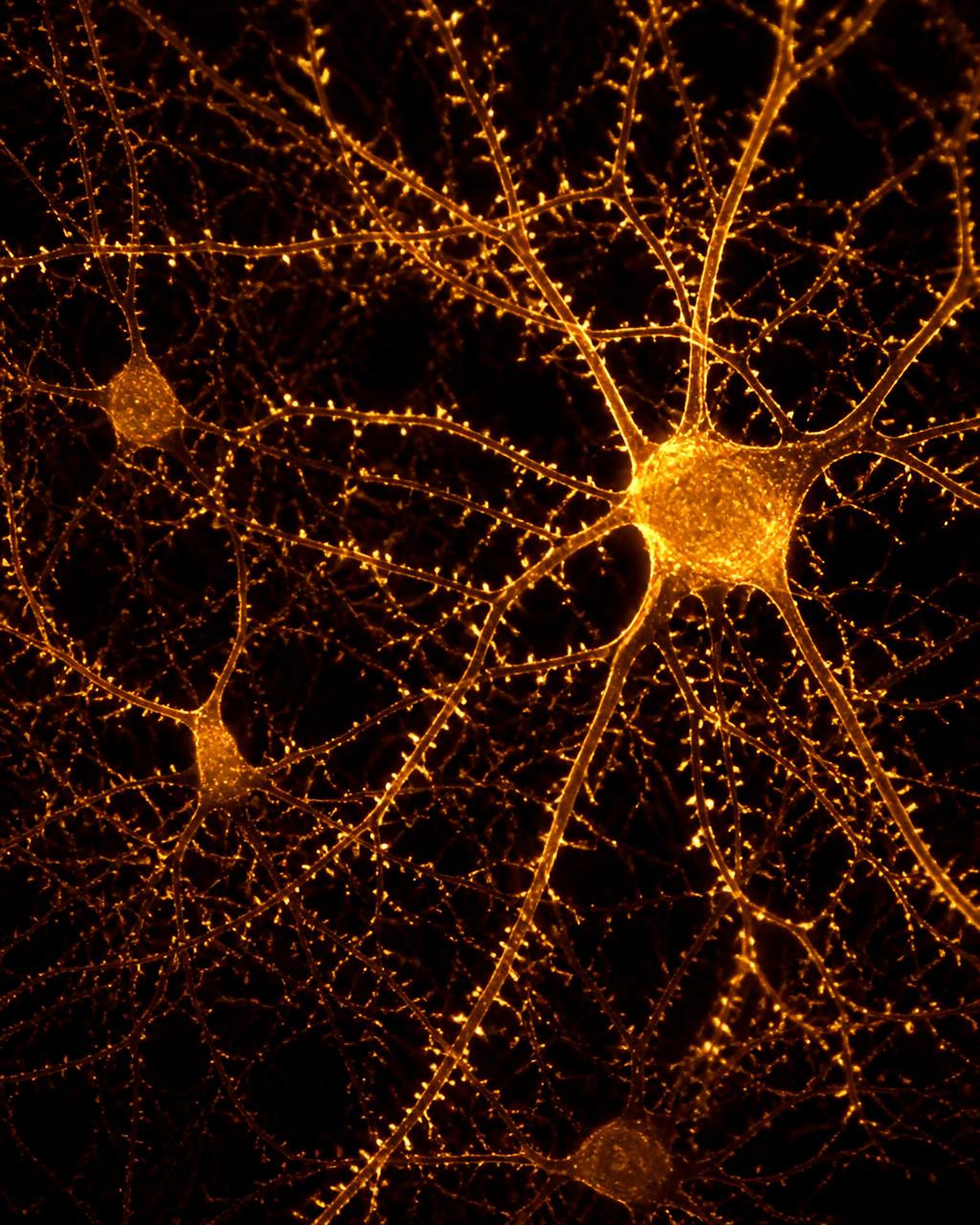 Microscopy of a golden neural network of neurons and synapses